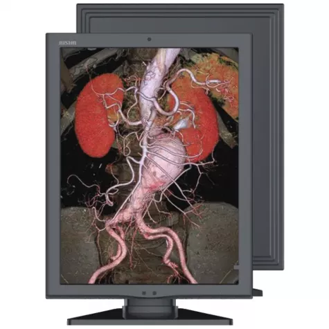 Медицинский цветной монитор Jusha C270G фото 1