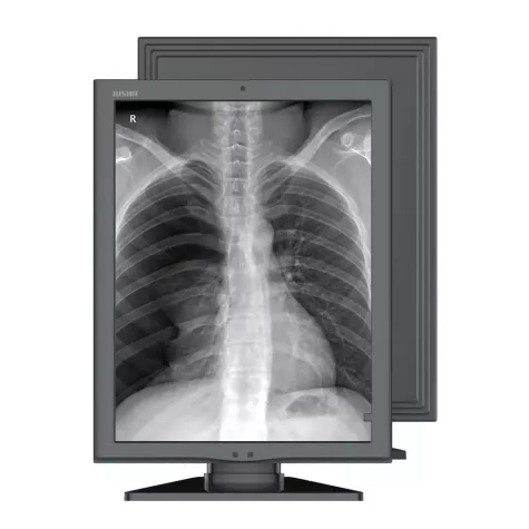 Медицинский монохромный монитор Jusha M260G фото 1